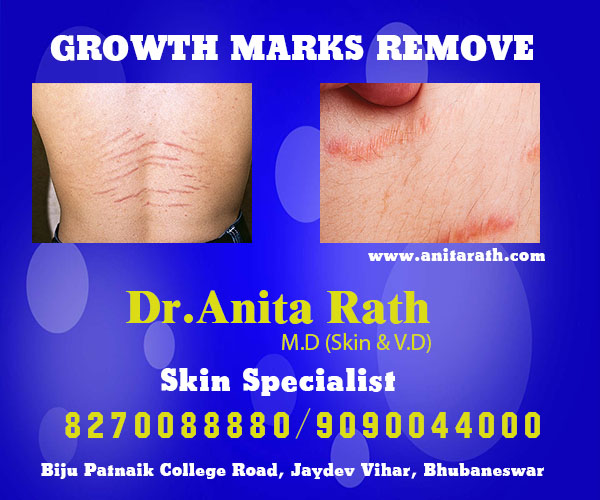 best skin treatment clinic in bhubaneswar near apollo hospital
